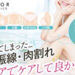ノコアクリームの販売店は?最安値は市販と通販どっち?